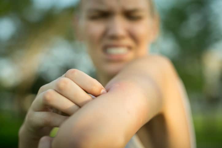 Summertime Safety: Bug Bites